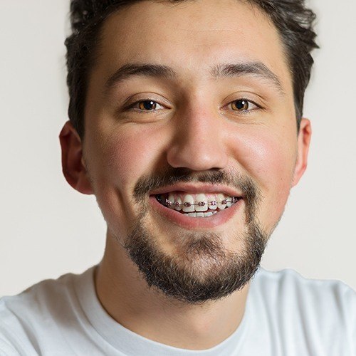 Young man with traditional braces