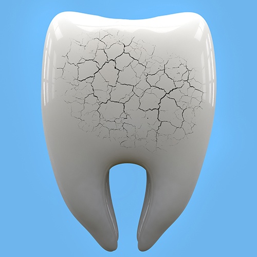 Animated tooth in need of dental crown restoration