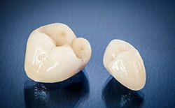 Close-up of a pair of dental crowns in Lacey, WA
