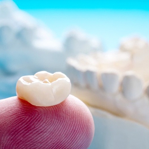 Dental crown in Lacey on dentist’s fingertip