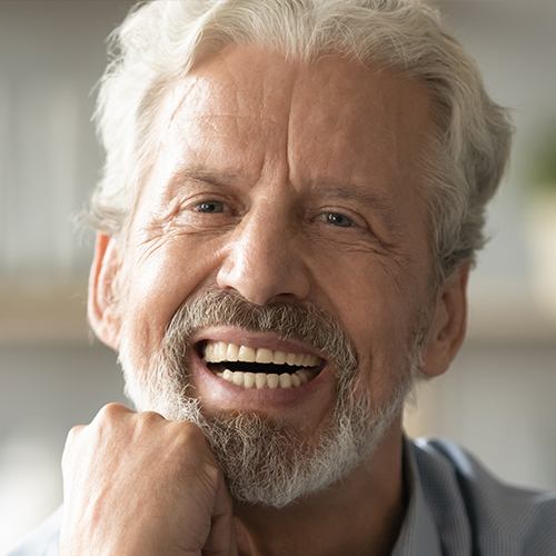 Man with dentures smiling