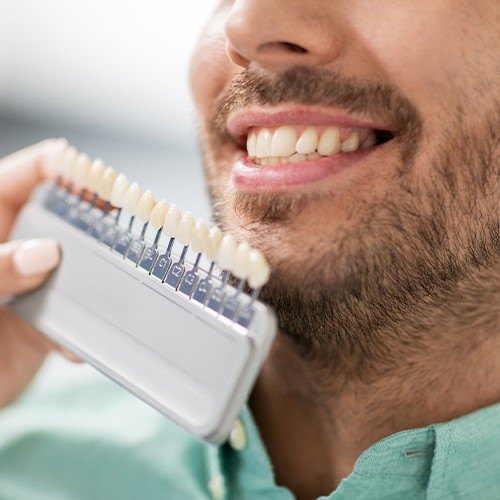 Man's smile compared with tooth color chart