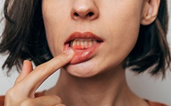 Woman pulling back her lip to reveal red gums