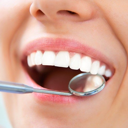 Dentist examining patient's smile after tooth colored filling treatment