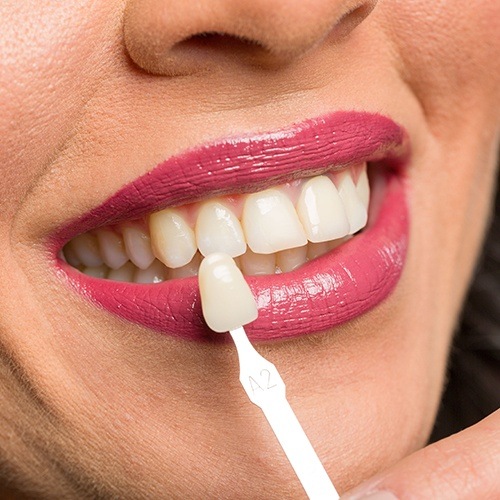 Smile compared to porcelain veneer sample after treatment