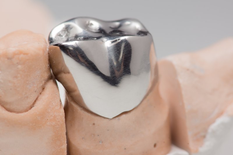 up-close view of metal dental crown