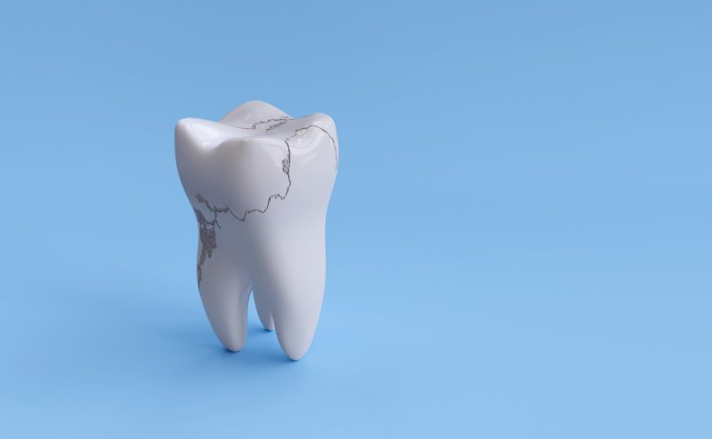 an image of a single tooth standing alone with numerous cracks throughout the enamel
