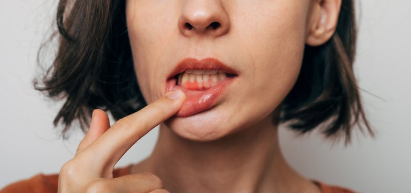 woman with red and swollen gums