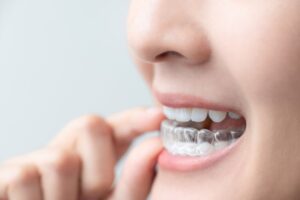 Close-up of person sliding clear aligner off their teeth