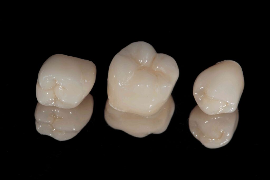 Closeup of dental crowns